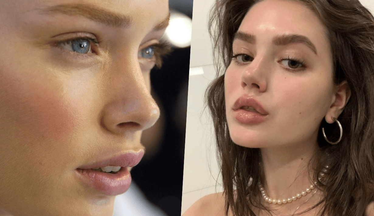 bullhorn lip lift surgery